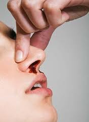 how to prevent nose bleeding in summer