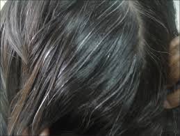 Prevent premature hair whitening