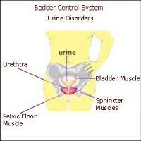 Urinary stress incontinence