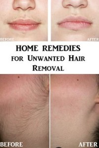 Unwanted Hair Removal