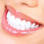 HOW TO STRAIGHTEN TEETH AT HOME EASILY WITHOUT BRACES